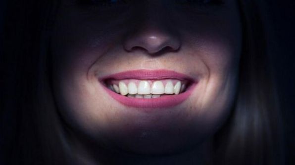 Приснилися зуби: як тлумачити подібні сновидіння і про що вони попереджають